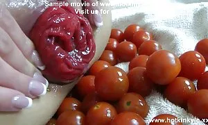 បន្លែរន្ធគូថ 50 ប៉េង ...